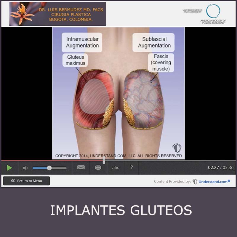 boton animacion gluteoplastia