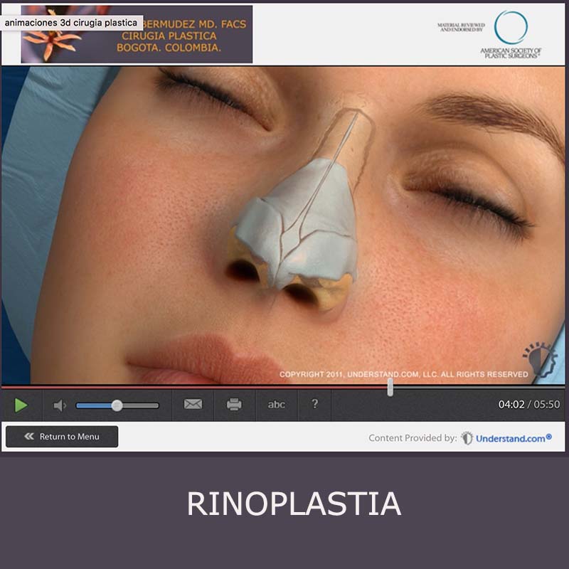 boton animacion rinoplastia