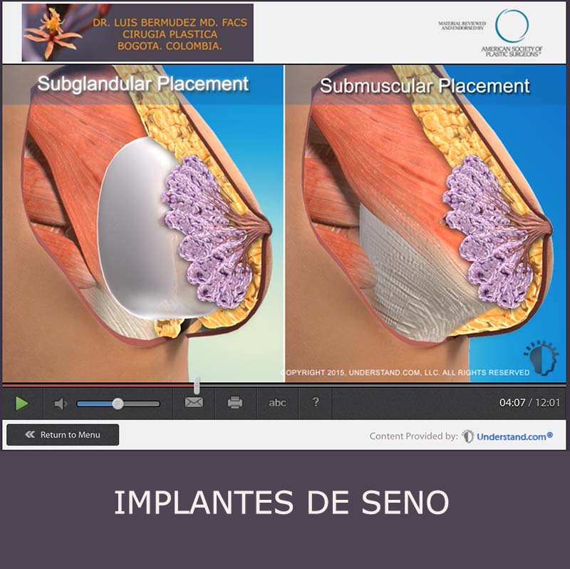 boton implantes de seno