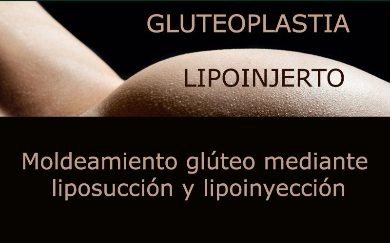 gluteoplastia con lipoinjerto