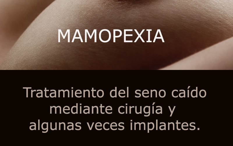 mamopexia boton